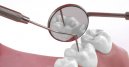 Intossicazione da amalgame dentali: effetti del mercurio sul SNC