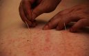 Aspetti medico-legali della medicina alternativa e complementare (CAM)