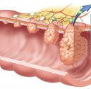 Tumori del colon-retto: un trattamento integrato multidisciplinare.