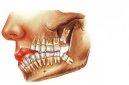 Fisiopatologia del dolore acuto post-operatorio e razionale scientifico della �pre-emptive analgesia�