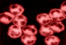 L�enigmatico ruolo della lipocaina 2 nell�insorgenza del cancro umano. La proteina multifunzionale lipocalina associata alla gelatinasi dei neutrofili (NGAL) ed il suo ambiguo ruolo nelle neoplasie umane.