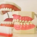Osteonecrosi dei mascellari da bisfosfonati: prevenzione, diagnosi e trattamento.